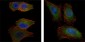AKT2 Antibody (clone 1B6)